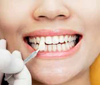 Dr. Shefali Tuli is a Cosmetic Dentist Near Waterloo ON