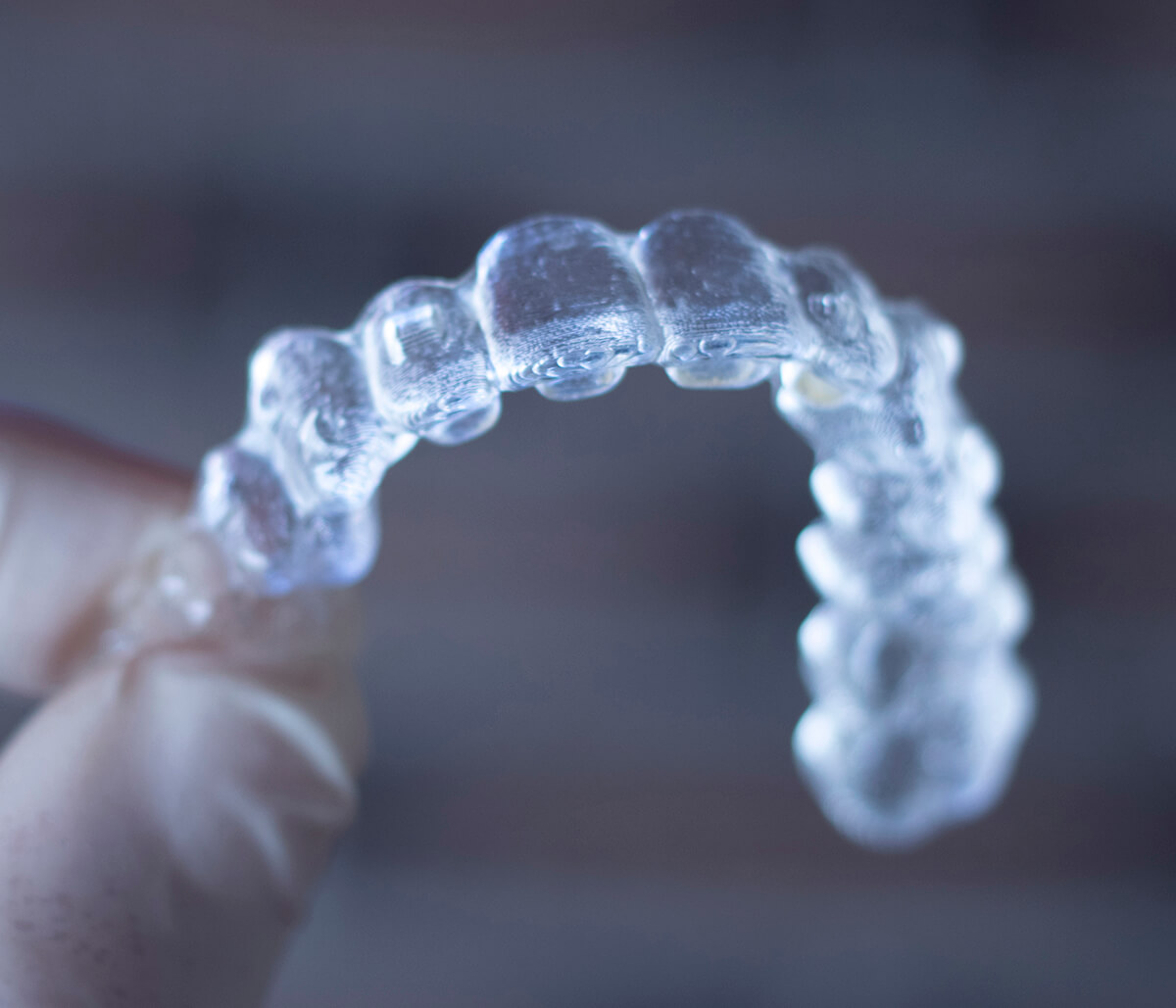 Invisalign Teeth Aligners in Waterloo ON Area